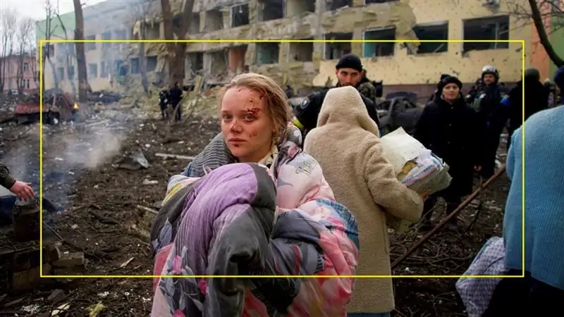 «Мне пришлось делать кесарево сечение в подземном убежище, без покрытия и без анестезии»