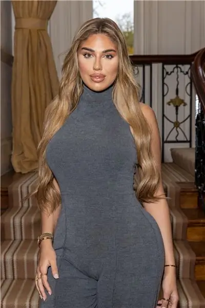 Анна Вакили из Love Island чуть не умерла во время бразильской операции по подтяжке ягодиц