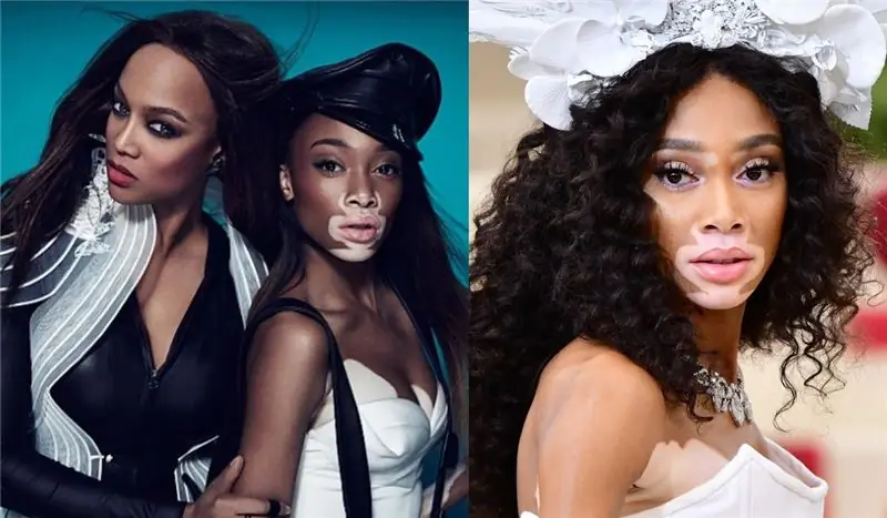 Винни Харлоу ANTM Винни Харлоу ANTM