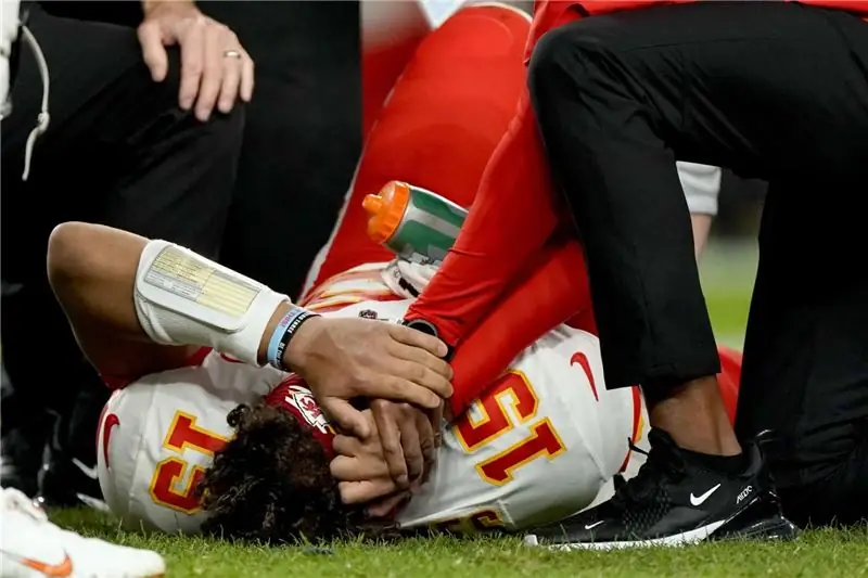 Вывих коленной чашечки Mahomes Вывих коленной чашечки Mahomes