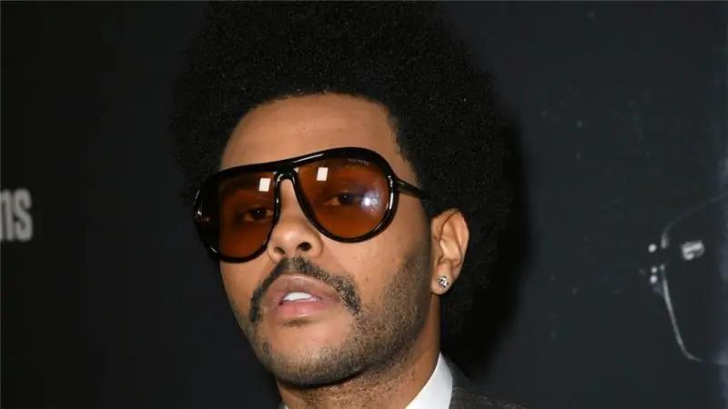 Настоящая причина, по которой лицо The Weeknd все еще в крови и синяках