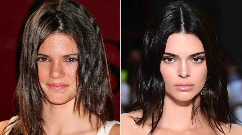 Кендалл Дженнер