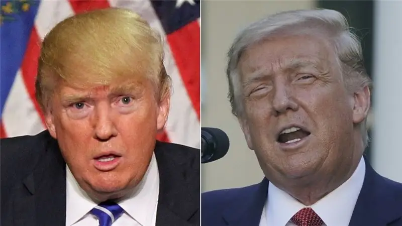 Дональд Трамп до и после Дональд Трамп до и после