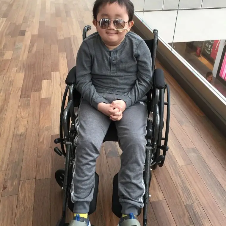 У 11-летнего Эдварда Лю диагностировали опухоль головного мозга, когда ему было 9 лет