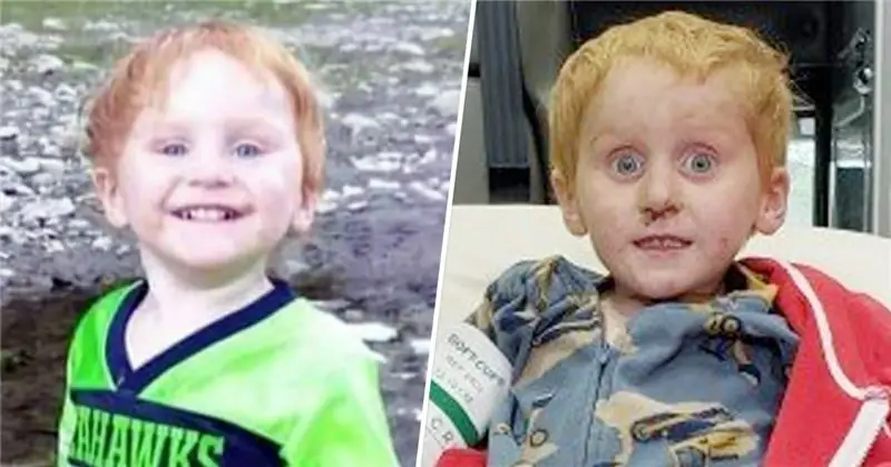 Как 3-летний мальчик из Монтаны выжил в одиночестве два дня в сельской местности Монтаны Как 3-летний мальчик из Монтаны выжил в одиночестве два дня в сельской местности Монтаны