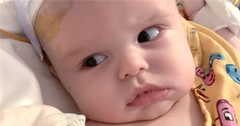 Baby's была слишком большой Мама беспокоилась. Это была опухоль головного мозга
