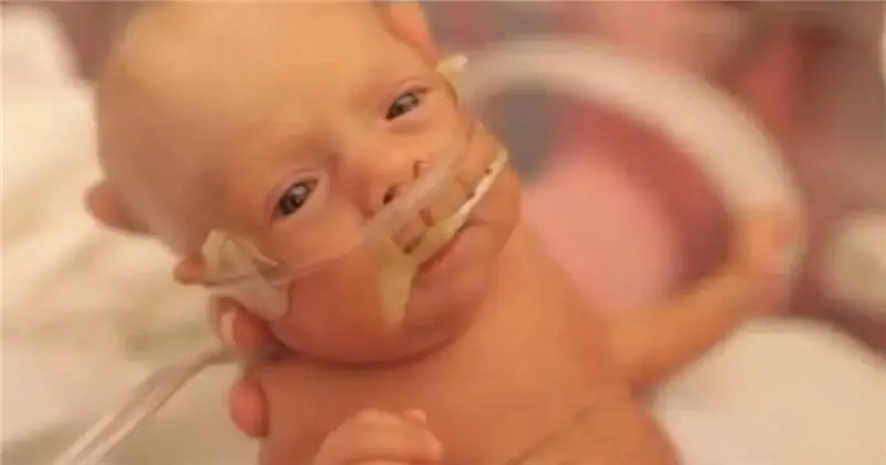 Dad'пронзительные видеохроники preemie son'путешествие из реанимации домой, милая, домой