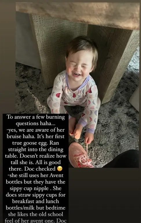 Сообщение Шона Джонсона Иста о синяке на лице дочери Дрю