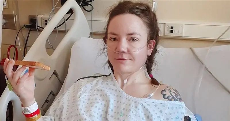 Woman'размер грейпфрута 'рак печени' опухоль на самом деле была гигантским паразитом
