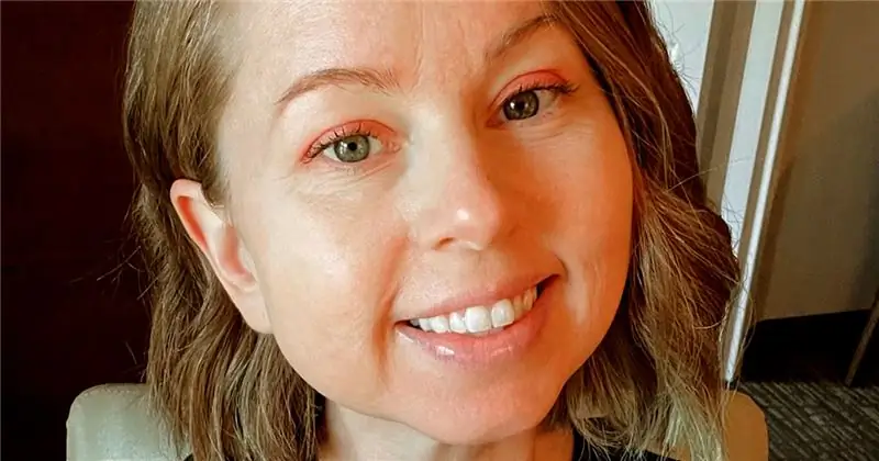 Woman's была раком меланомы, но родинки не было