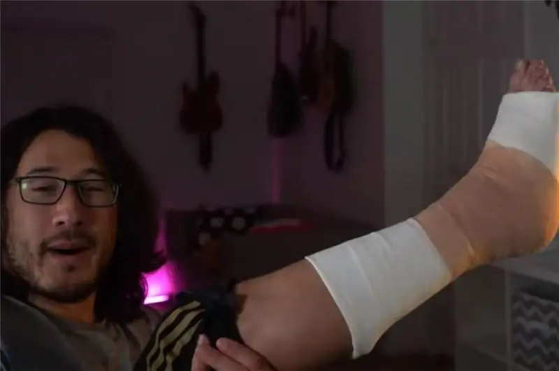YouTube Личность Markiplier ломает ногу