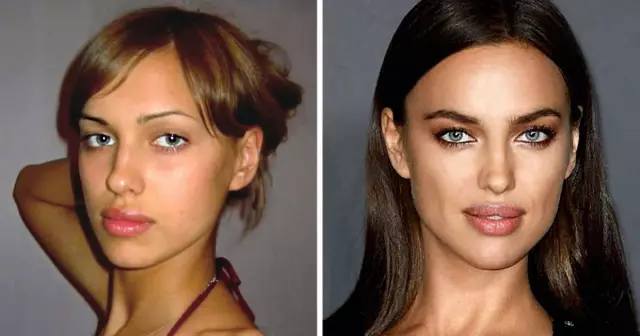 20 знаменитостей, которые пытались завести детей (но не повезло)