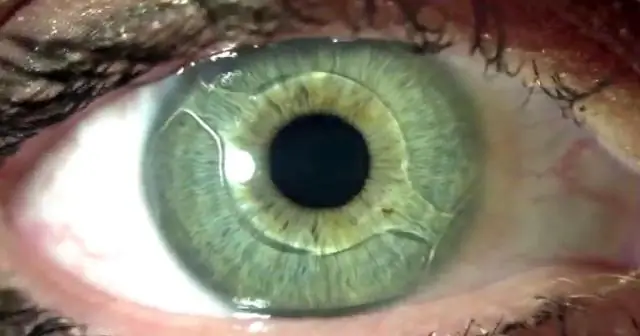 Как я могу посмотреть игру Бронкос?