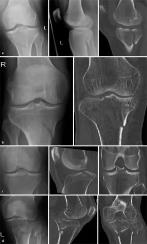 Что такое пример или классификация?