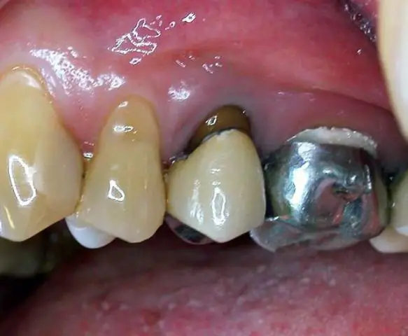 Развертывается ли береговая охрана?