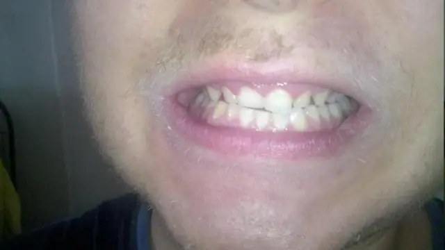 Что такое Sodexo UK?