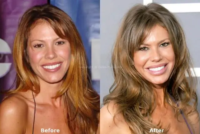 Career Killer Botox, силикон & Co
